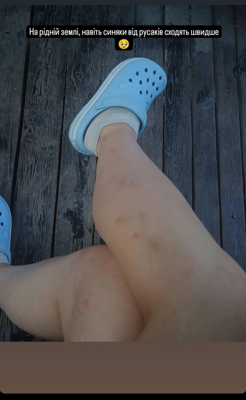 Звільнена з полону слідча Мар'яна Чечелюк вперше за два роки побачила маму: щемливе відео до сліз