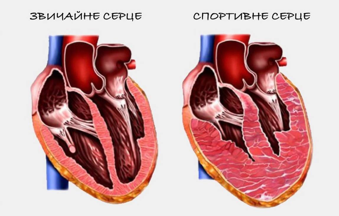 Тренер розповіла, як біг може серйозно нашкодити здоров'ю