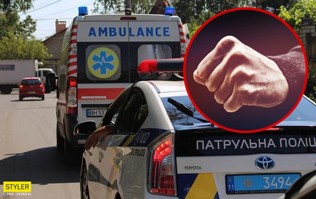 У Києві чоловік по-звірячому побив свого друга: у всьому винні ревнощі