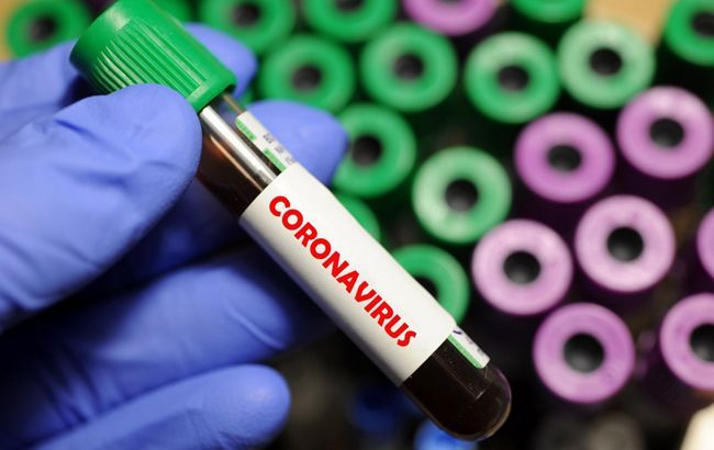 У Південній Кореї визначили 38 антитіл для нейтралізації коронавірусу
