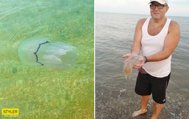 Пляжи Азовского моря атакуют опасные медузы: люди показывают ожоги