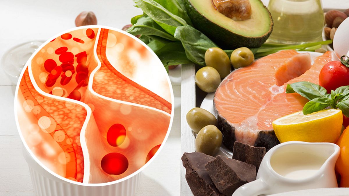 Три беспроигрышных способа снизить холестерин