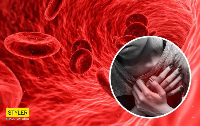 Ученые определили группу крови, которая наиболее подвержена болезням сердца