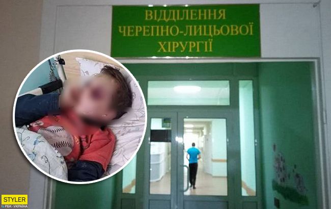 Голова в гематомах: в Винницкой области избили шестилетнего ребенка
