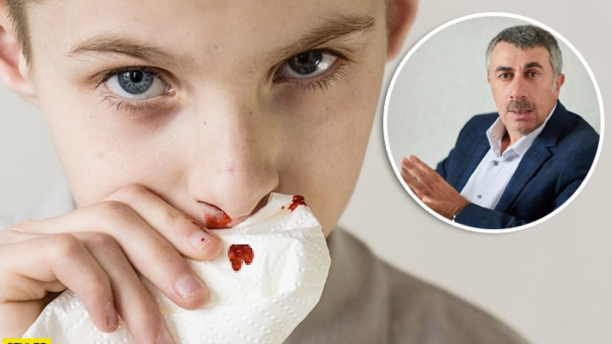 Что вызывает носовое кровотечение?