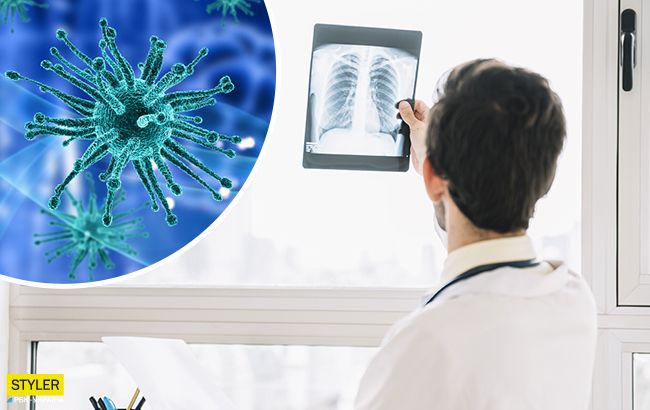 Коронавирус прячется от рентгена: медики нашли объяснение