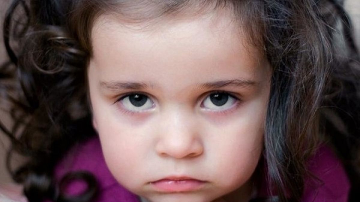 Признаком каких патологий могут быть синяки под глазами у детей?